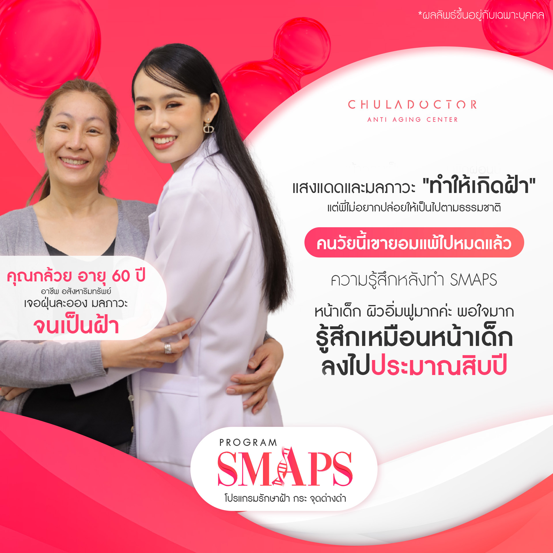 รักษาฝ้า