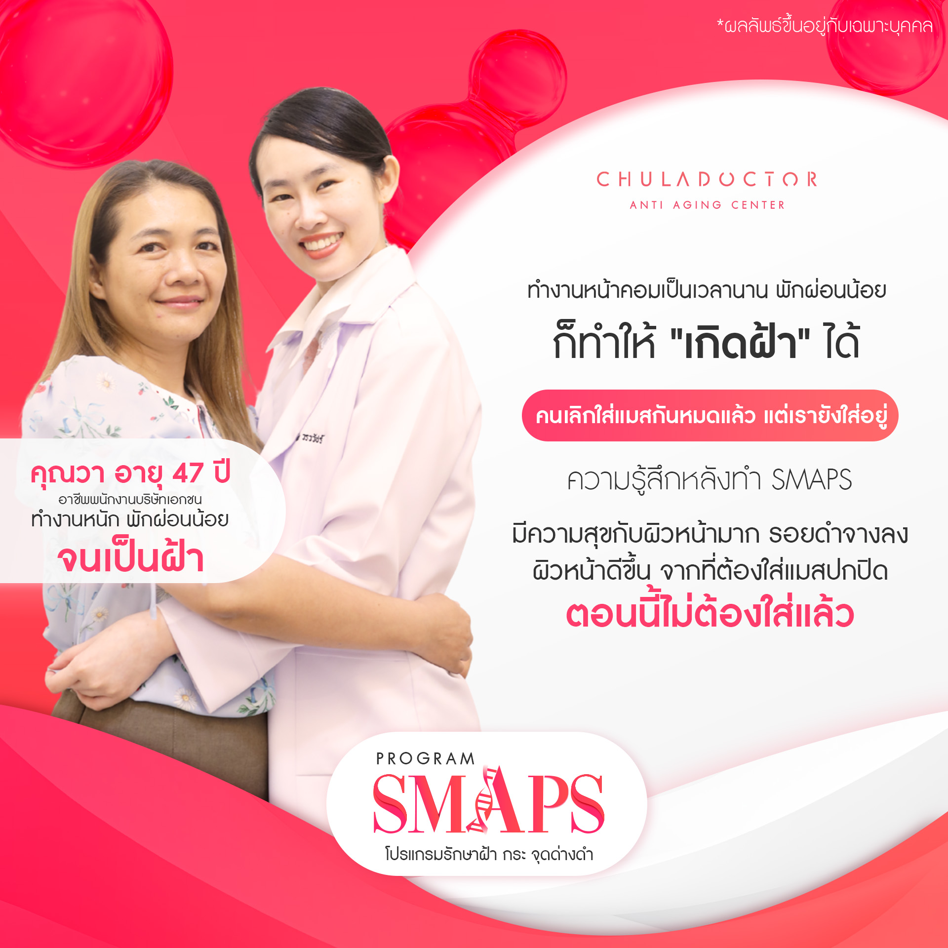 รักษาฝ้า