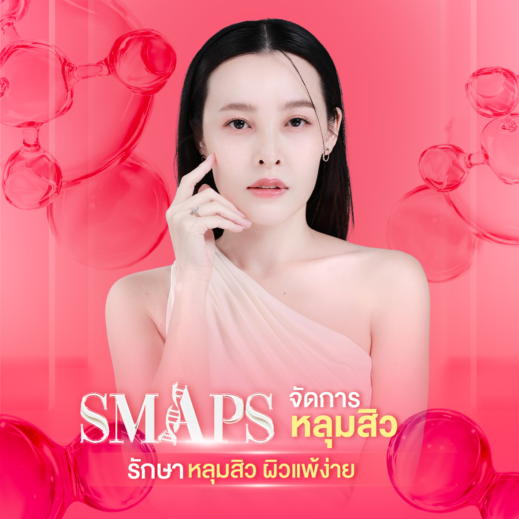 รักษาหลุมสิว