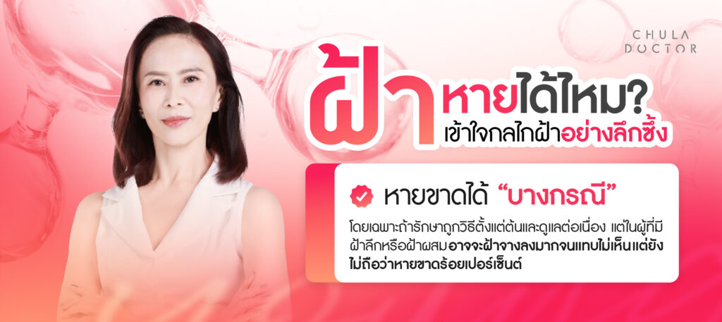 ฝ้าหายยาก แล้วหายได้ไหม เข้าใจกลไกฝ้าอย่างลึกซึ้ง