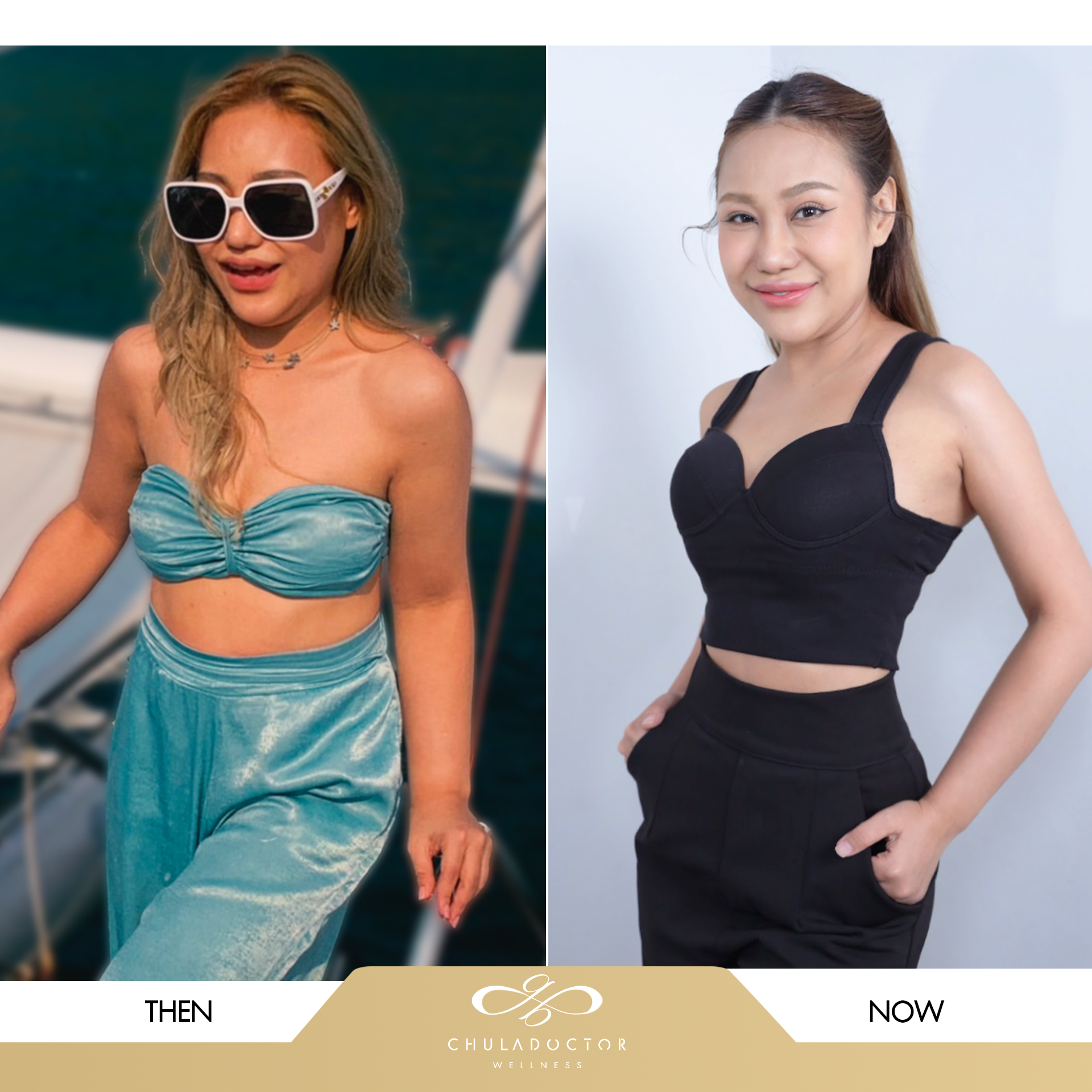 รีวิว-ลดน้ำหนัก-lisa-แอม