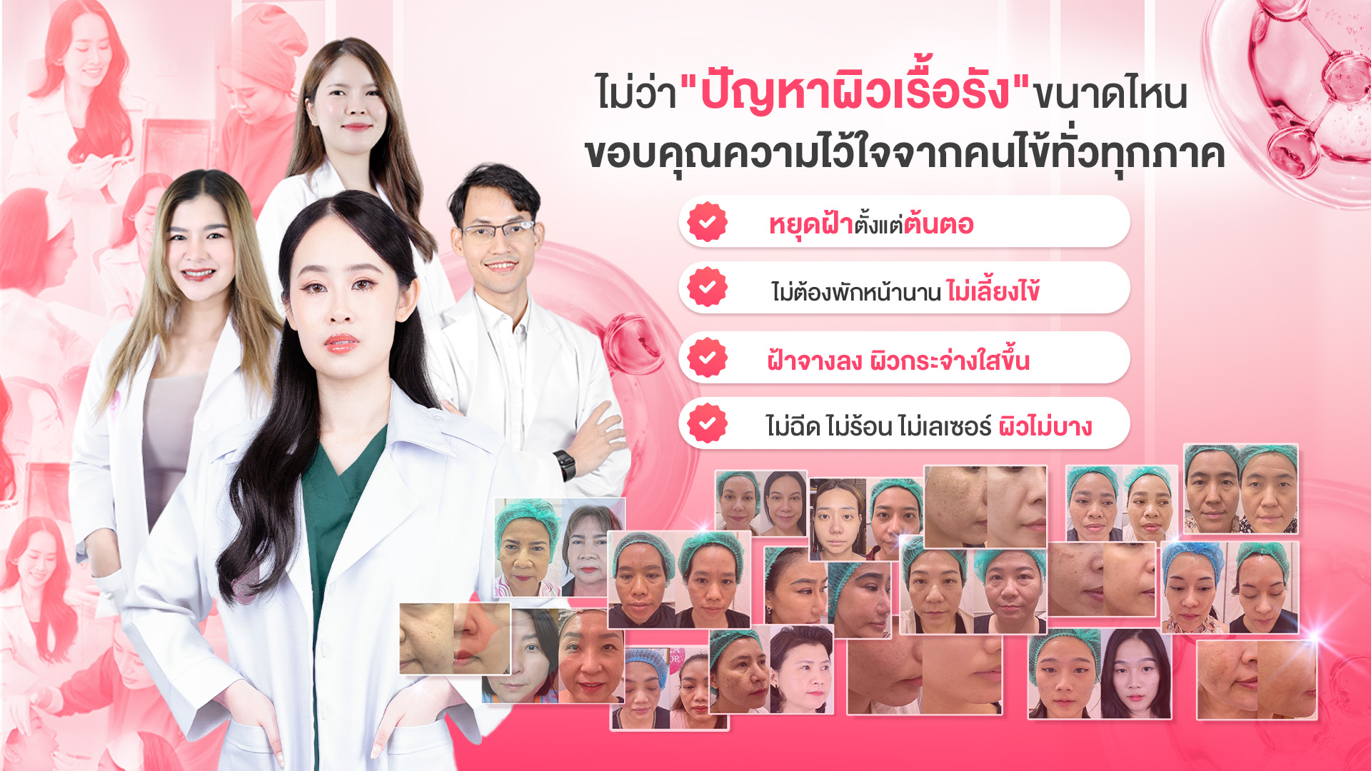 รักษาฝ้า