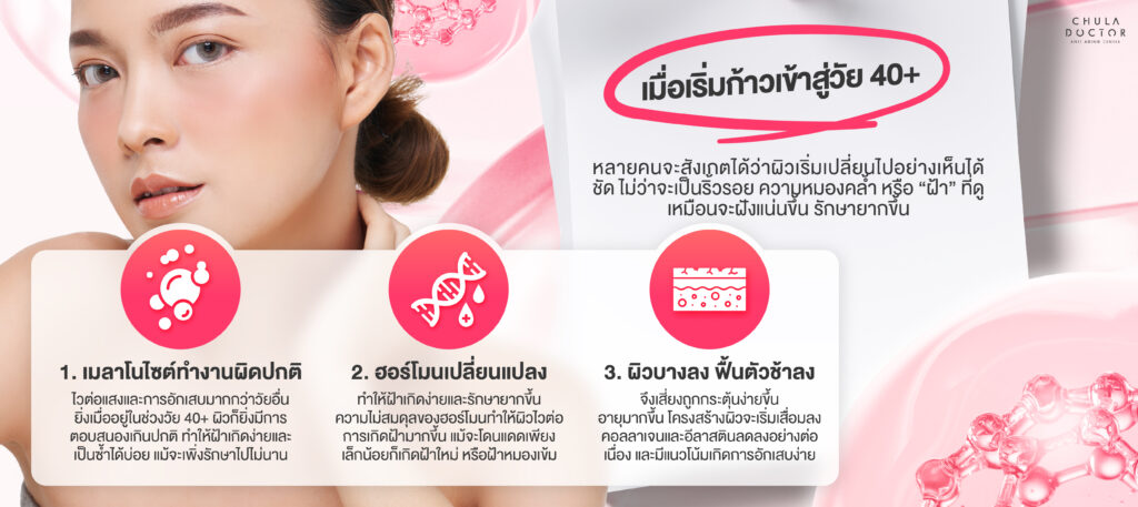 เมื่อเราก้าวเข้าสู่วัย40+ สาเหตุที่ทำให้เกิดฝ้ามีอะไรบ้าง