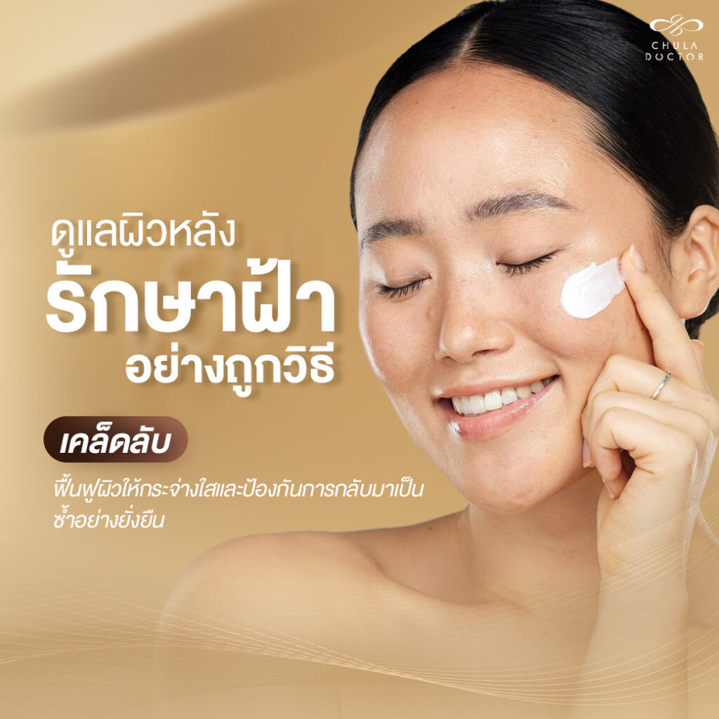 ดูแลผิวหลังรักษาฝ้า