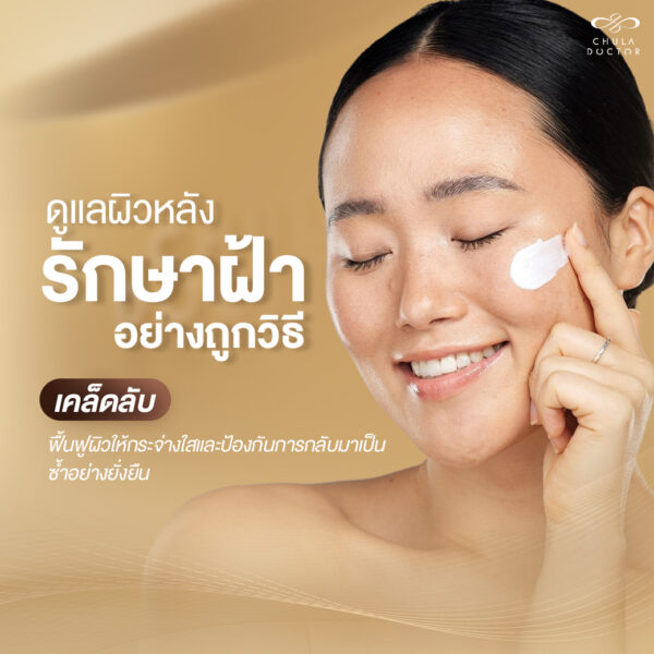 ดูแลผิวหลังรักษาฝ้า