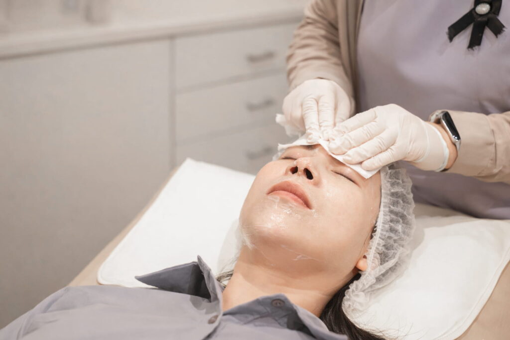 รักษาฝ้า