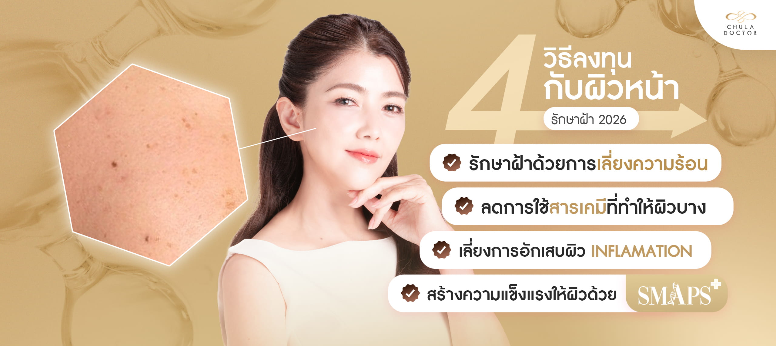 4 วิธีรักษาฝ้า 2026