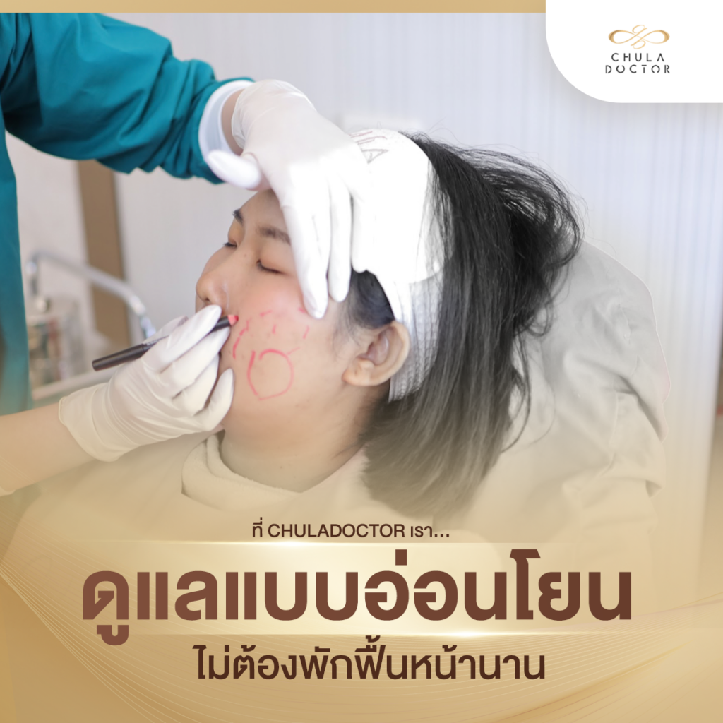 รักษาฝ้า