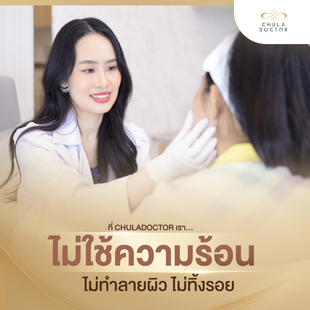 รักษาฝ้า