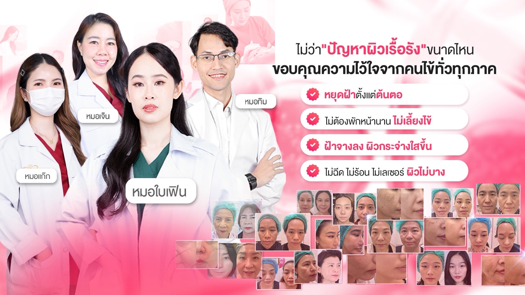 รักษาฝ้า