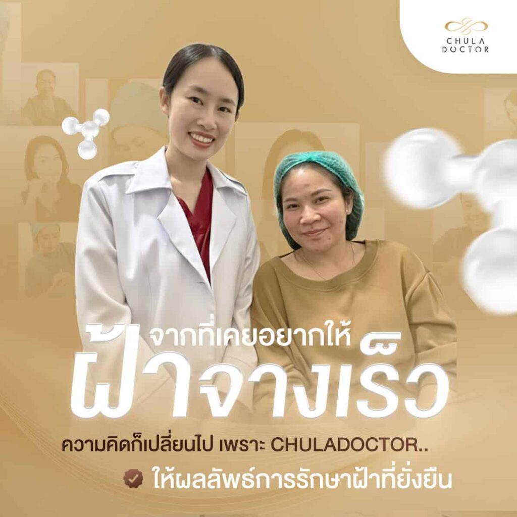 รักษาฝ้า