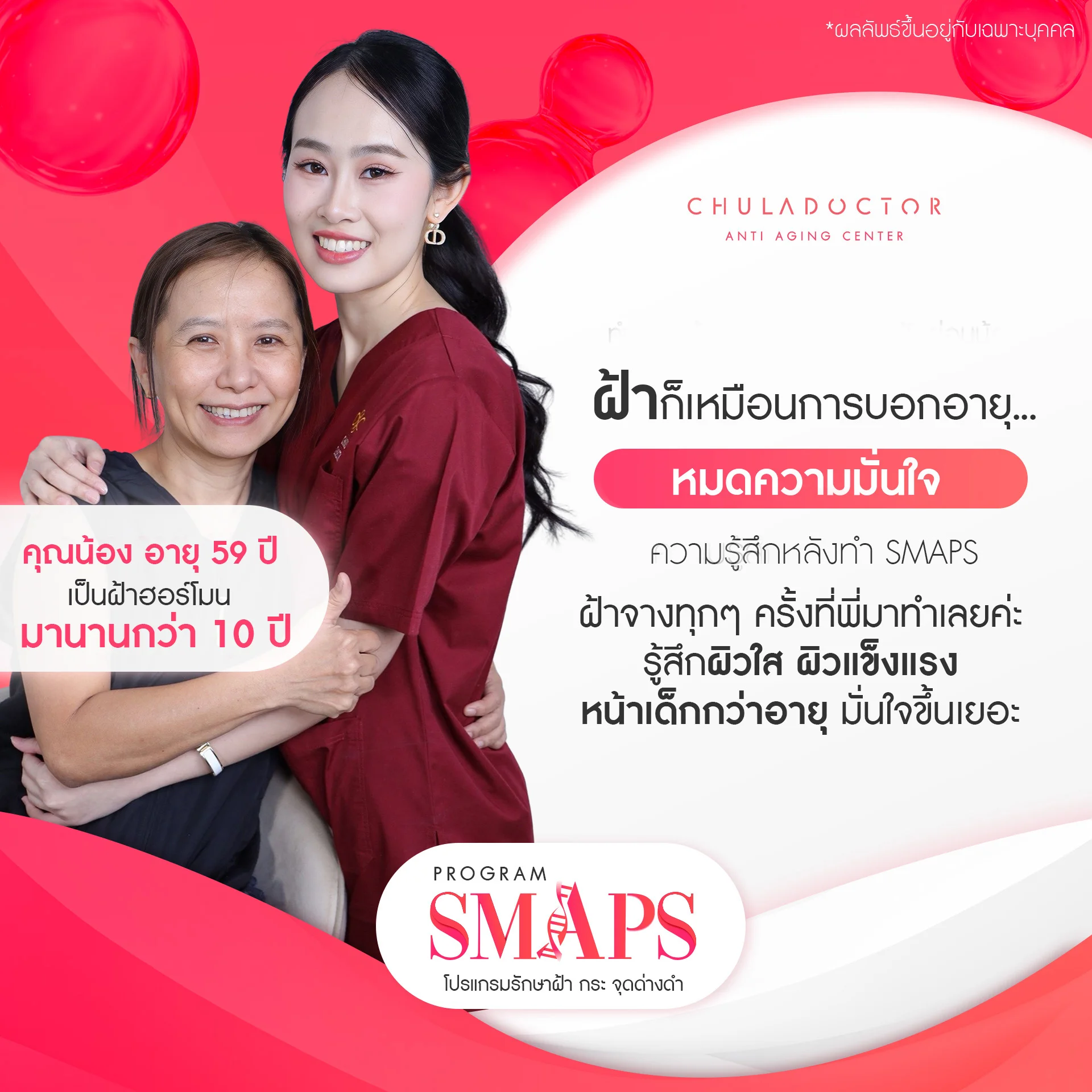 รักษาฝ้า 