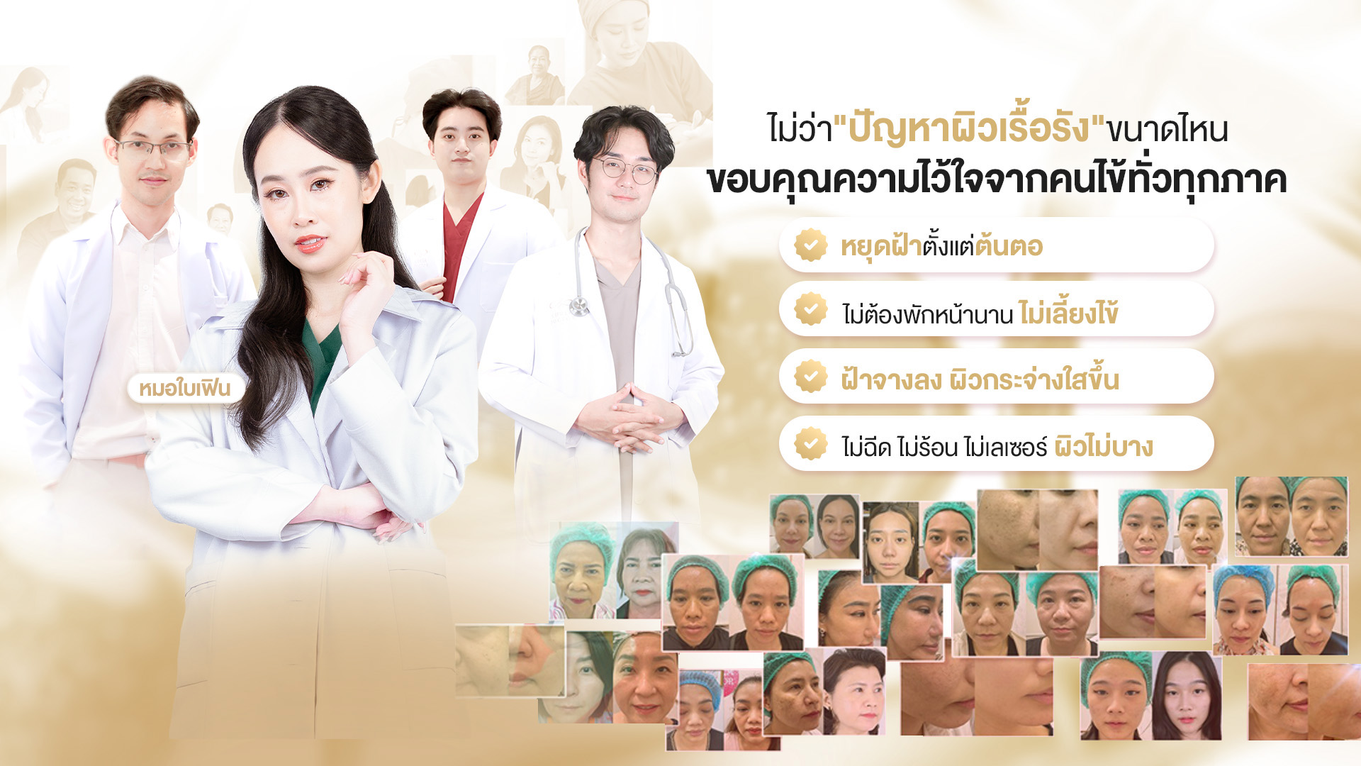 รักษาฝ้า