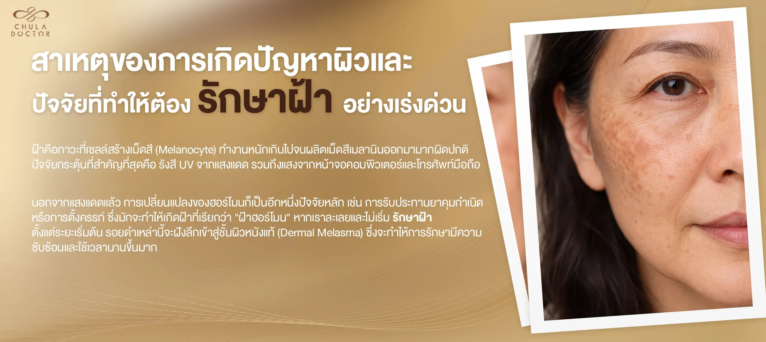 สาเหตุของการเกิดปัญหาผิวและปัจจัยที่ทำให้ต้อง รักษาฝ้า อย่างเร่งด่วน